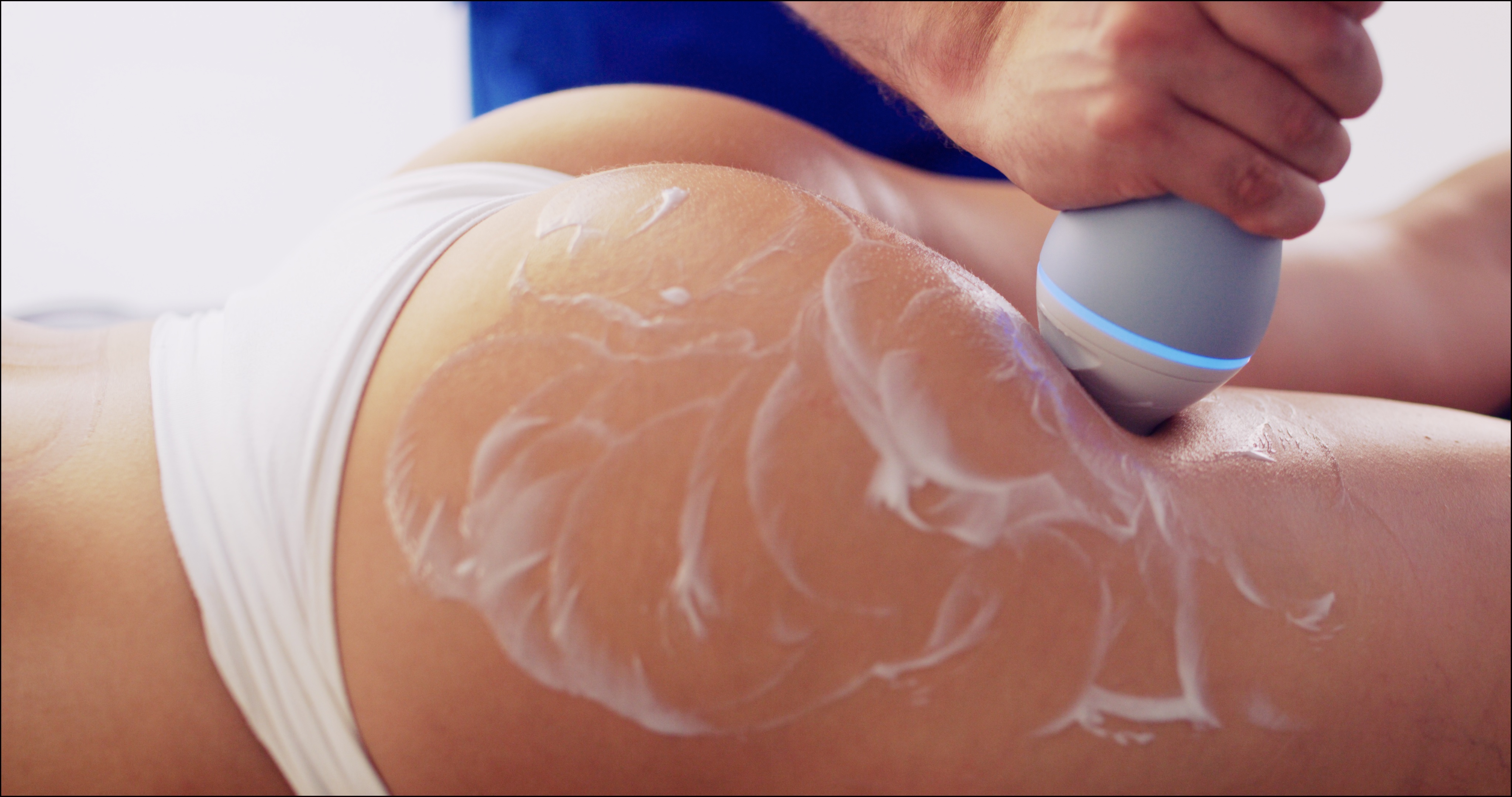 emtone_pic_detail-buttock_en100.jpg