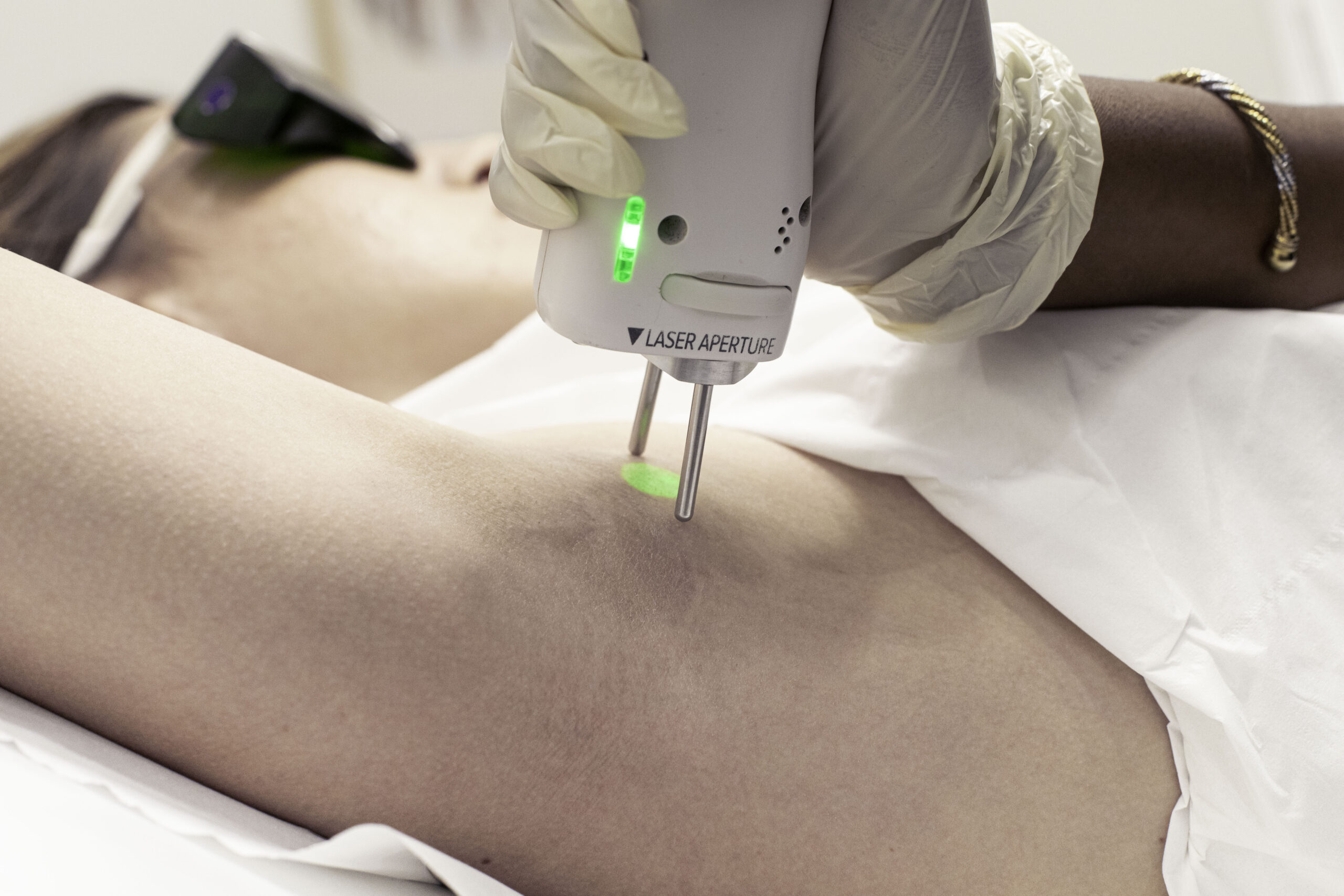 Séance d’épilation laser des aisselles à l’Institut Lazeris
