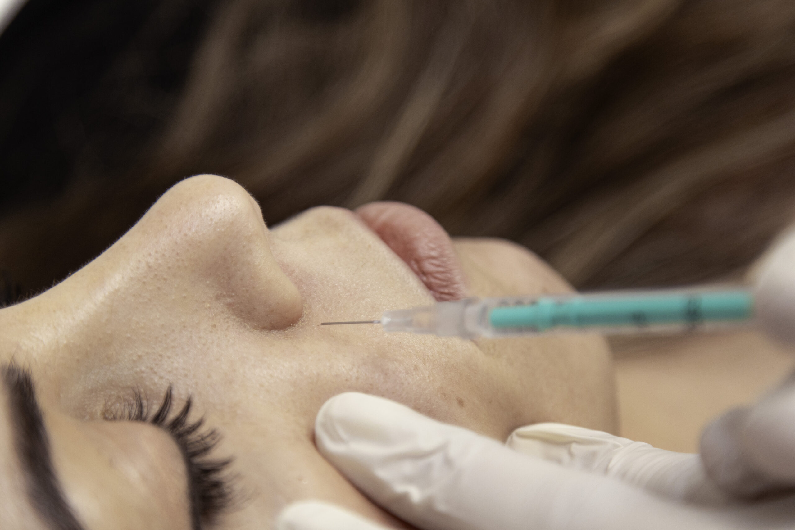 Deuxième étape : <br>L'injection Deuxième étape : <br>L'injection
