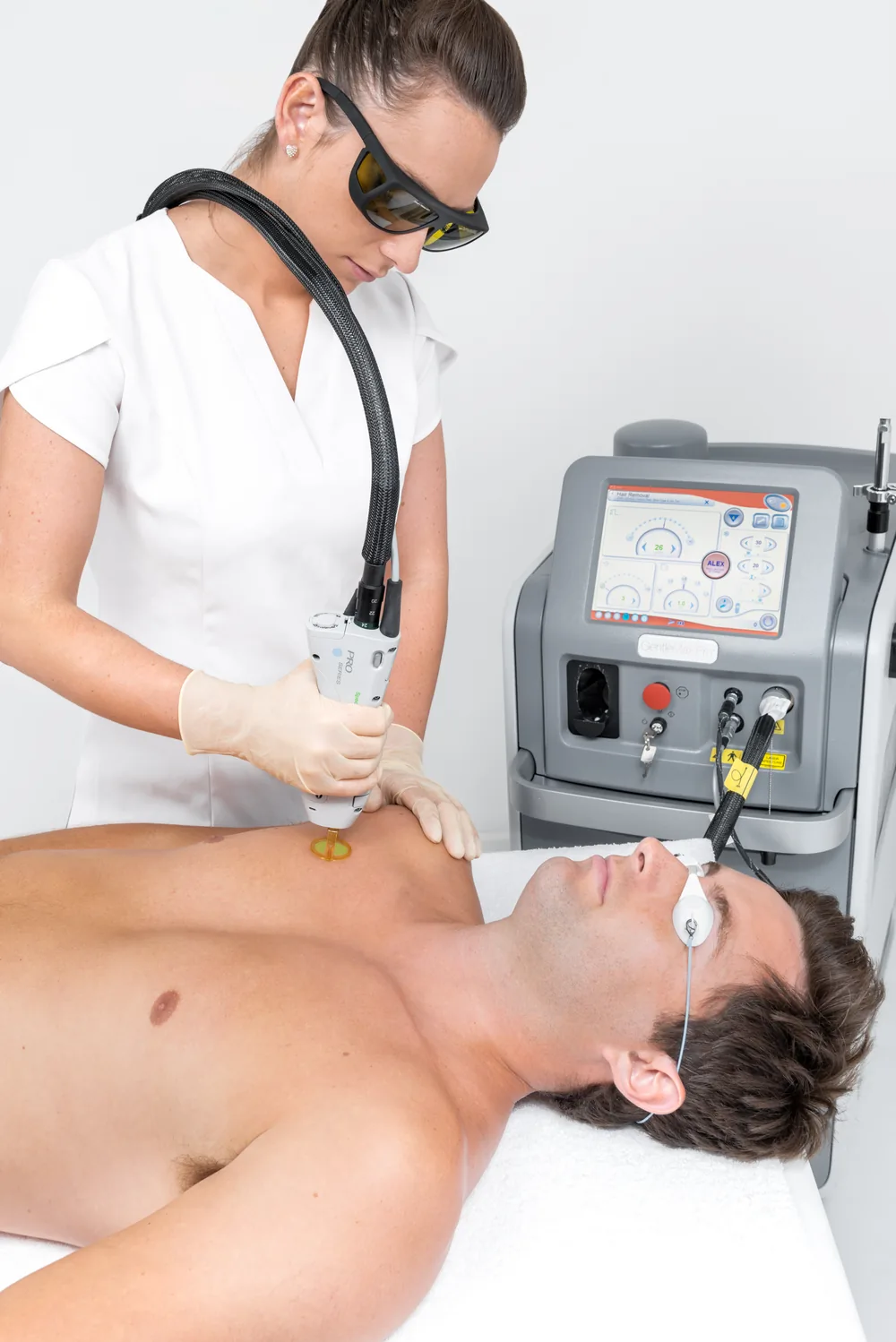 épilation laser homme paris