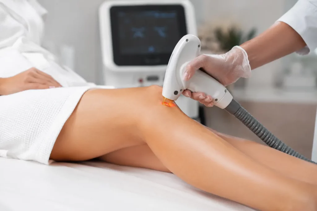 Séance d’épilation laser sur une jambe
